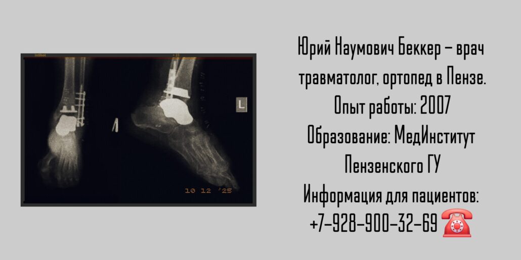 Беккер Юрий Наумович - травматолог в Пензе