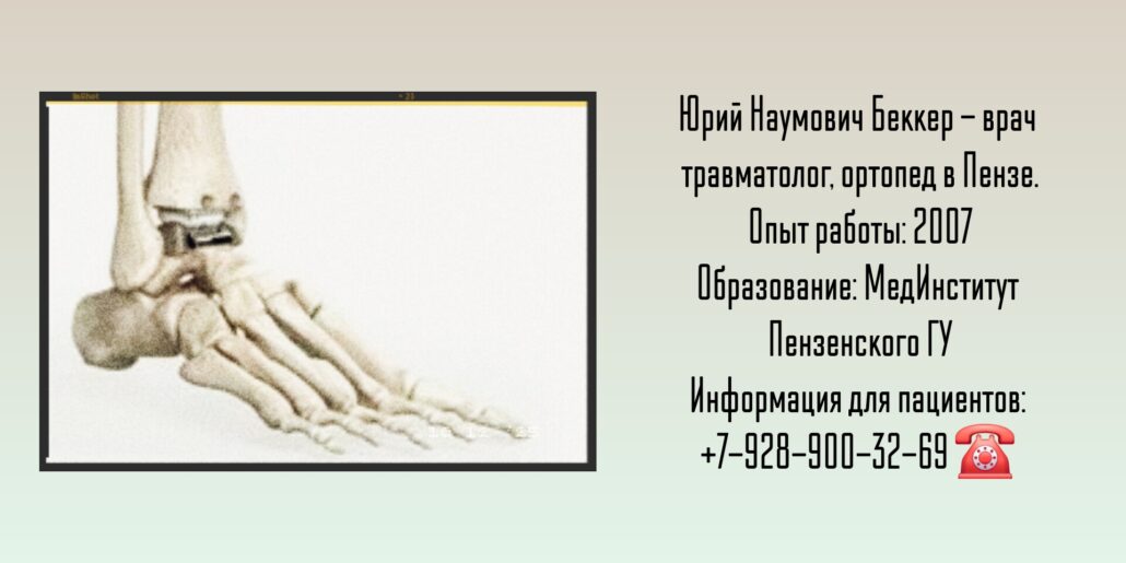 Беккер Юрий Наумович - травматолог в Пензе