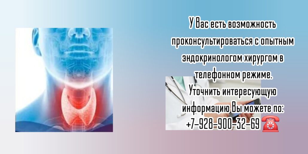 Онлайн консультация опытного эндокринолога хирурга - Зинкевич Игорь Олегович 