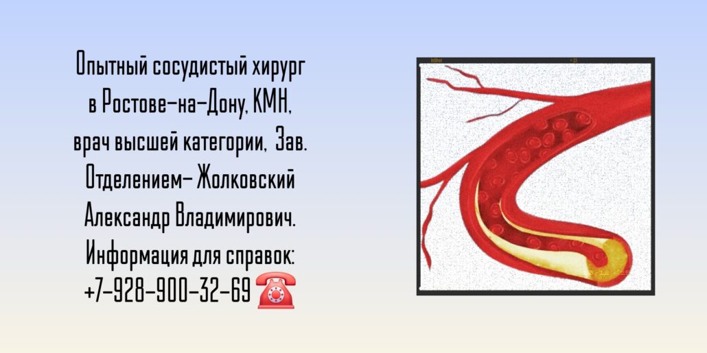 Ведущие сосудистые хирурги Ростова-на-Дону и РО - Жолковский Александр Владимирович