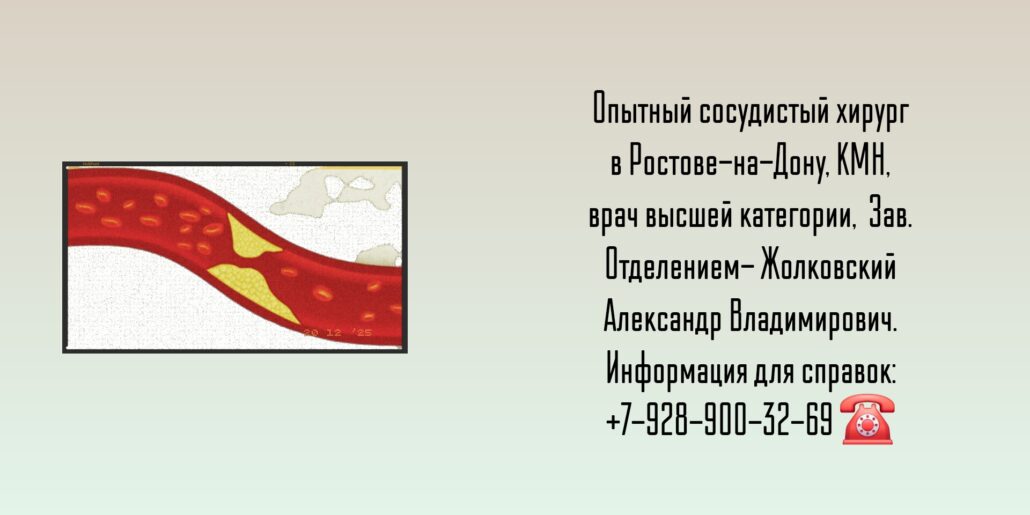 Ведущие сосудистые хирурги Ростова-на-Дону и РО - Жолковский Александр Владимирович