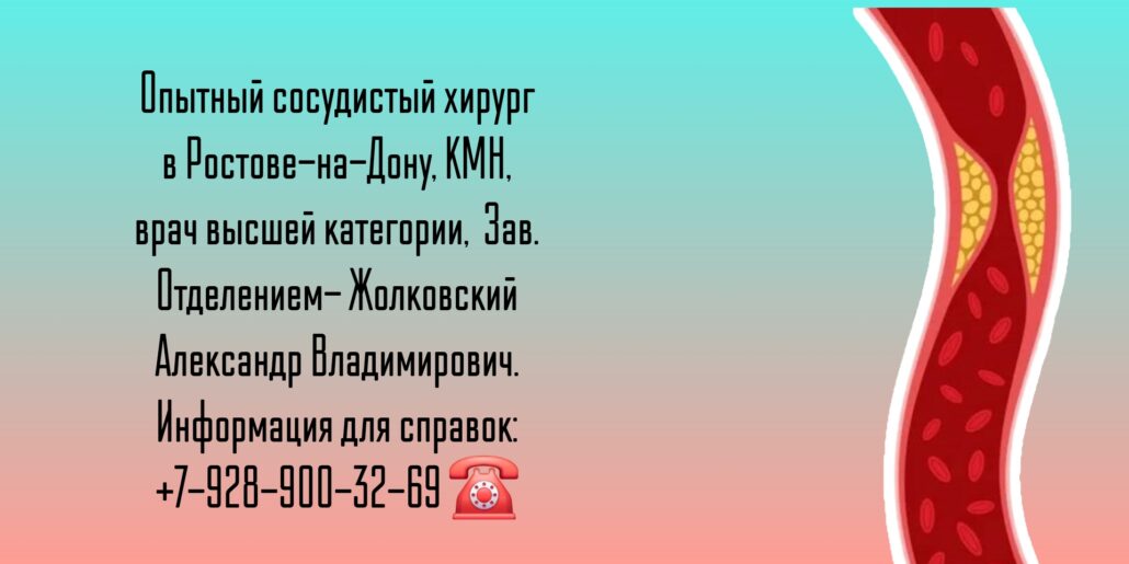 Ведущие сосудистые хирурги Ростова-на-Дону и РО - Жолковский Александр Владимирович