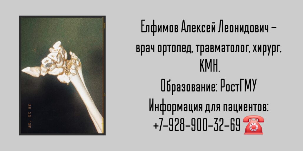 Травматолог - ортопед в Ростове-на-Дону - Елфимов Алексей Леонидович