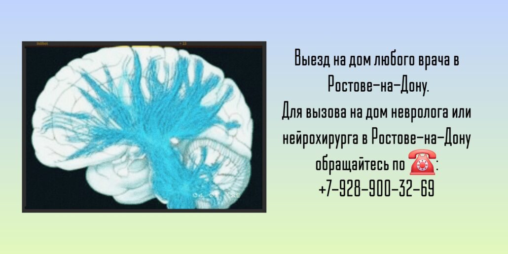 Невролог вызов на дом Ростов-на-Дону 
