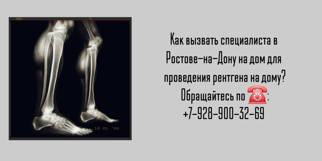 Рентген Ростов - вызов на дом 