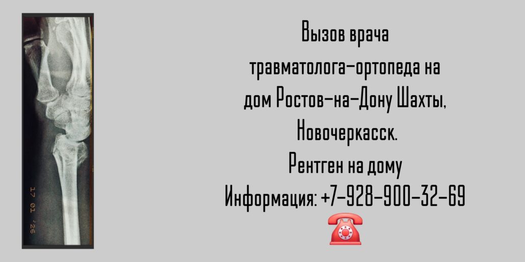 Травматолог-ортопед Ростов-на-Дону на дом