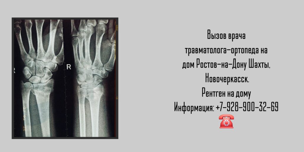 Травматолог-ортопед Ростов-на-Дону на дом