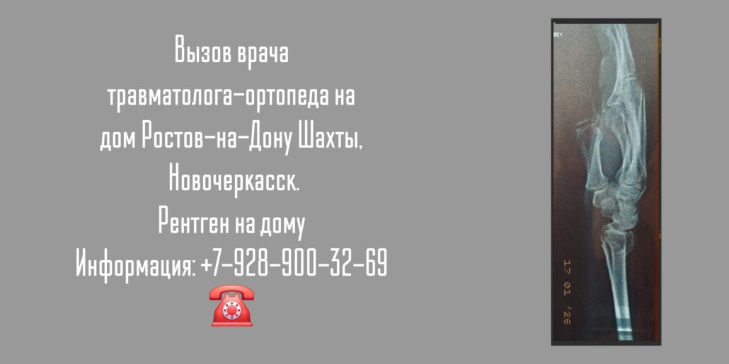 Травматолог-ортопед Ростов-на-Дону на дом