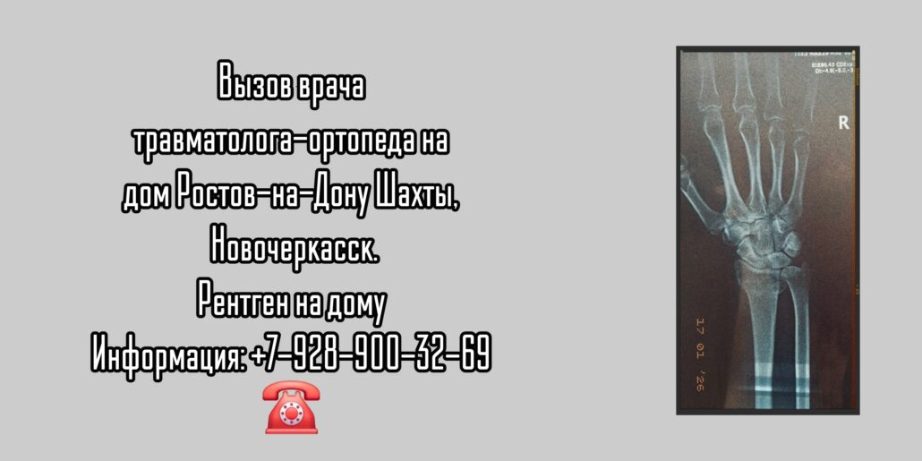 Травматолог-ортопед Ростов-на-Дону на дом