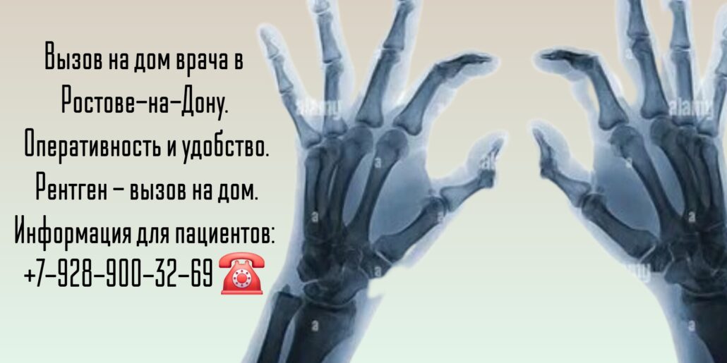 Ростов - Рентген - врач на дом: удобство диагностики
