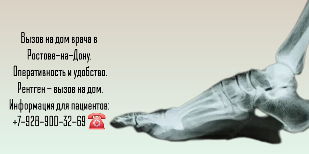 Ростов - Рентген - врач на дом: удобство диагностики
