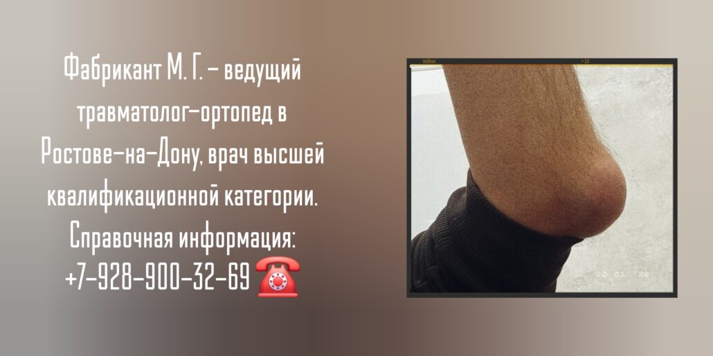 Хирург - травматолог Ростов-на-Дону - Фабрикант Михаил Геннадиевич