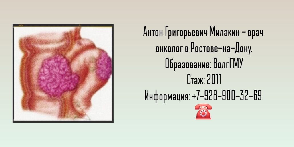 Онколог Ростов-на-Дону - Милакин Антон Григорьевич