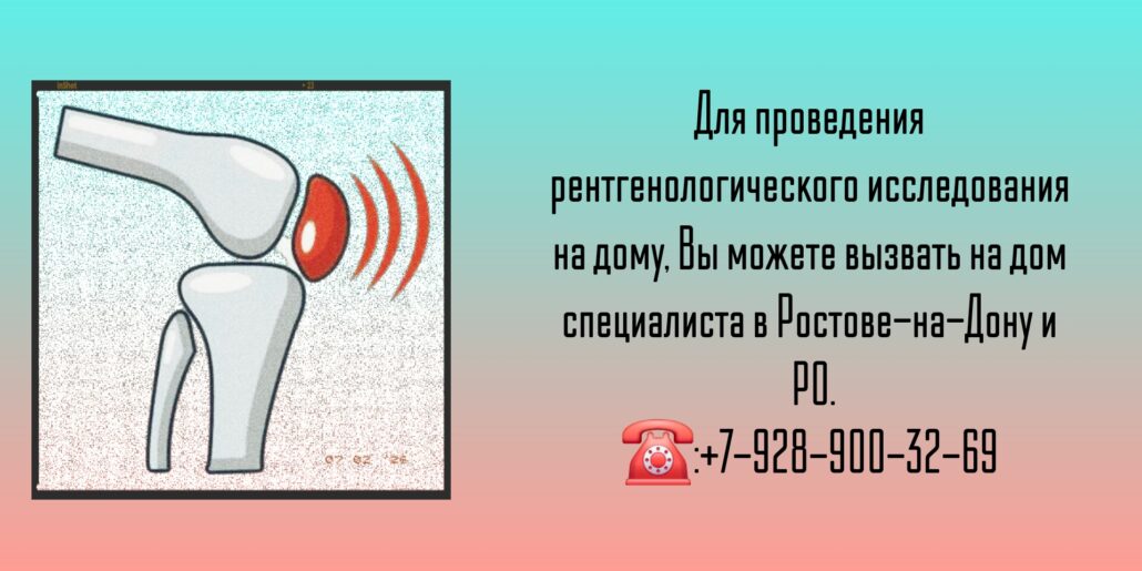 Вызов на дом - Ростов-на-Дону - Рентген 