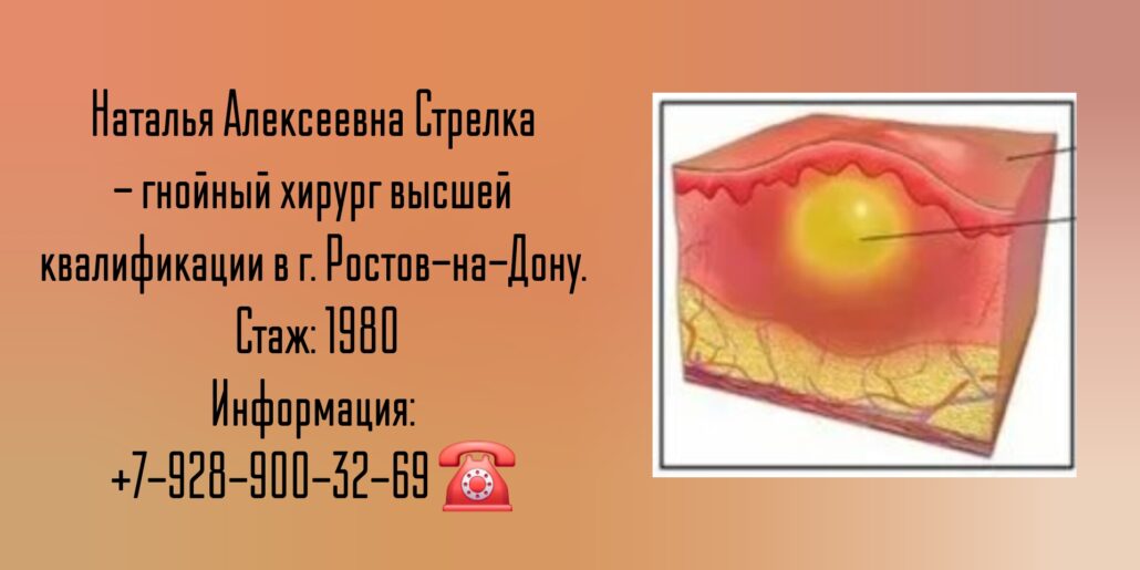 Стрелка Наталья Алексеевна - гнойный хирург Ростов-на-Дону