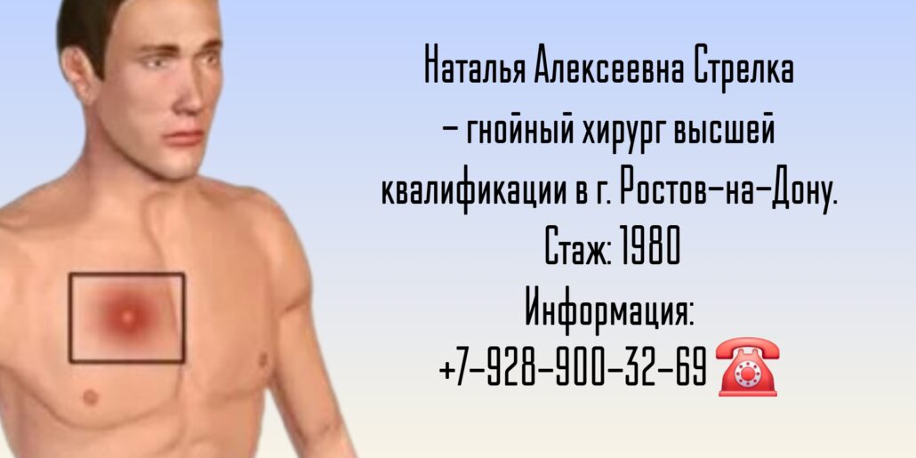 Стрелка Наталья Алексеевна - гнойный хирург Ростов-на-Дону