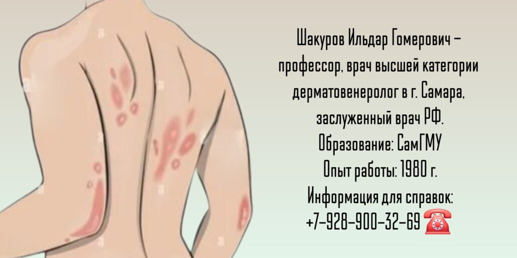 Дерматолог- венеролог Самара - Шакуров Ильдар Гомерович