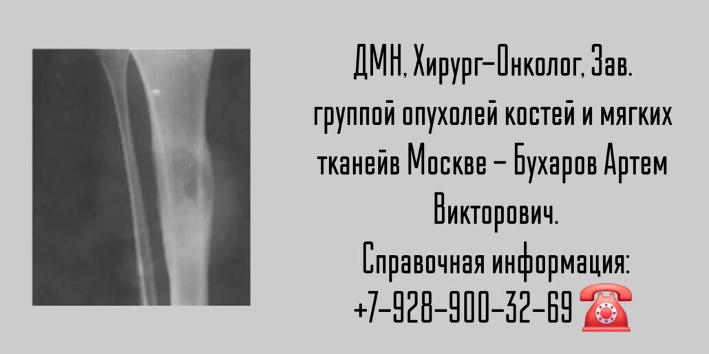 Бухаров Артем Викторович - онколог Москва