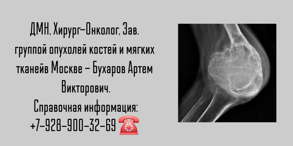 Бухаров Артем Викторович - онколог Москва