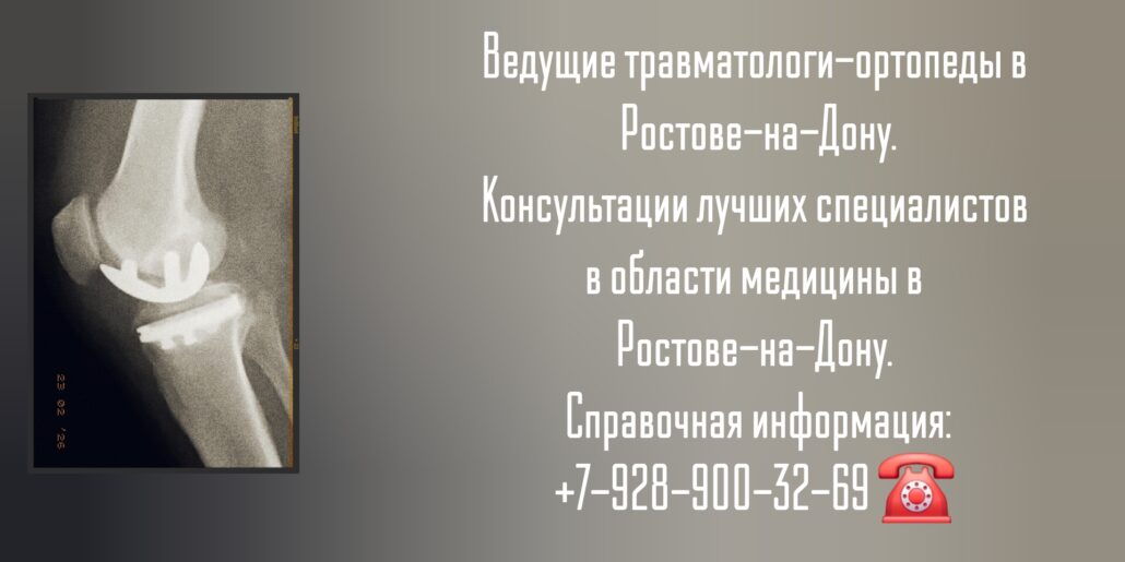 Консультация травматолога-ортопеда Ростов-на-Дону - Глухов Алексей Вячеславович