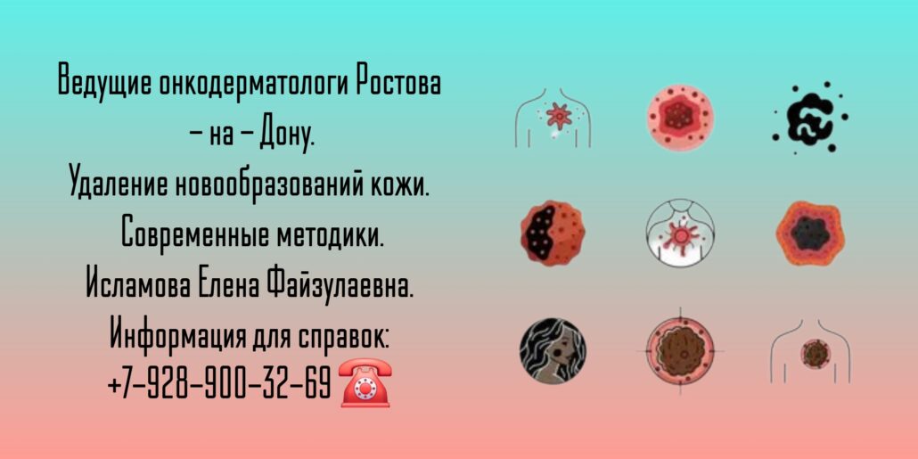 Новообразования на коже - удаление в Ростове-на-Дону