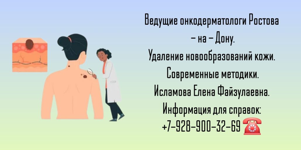 Новообразования на коже - удаление в Ростове-на-Дону