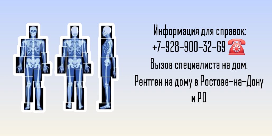 Рентген на дому - Ростов-на-Дону удобство и безопасность для вашего здоровья