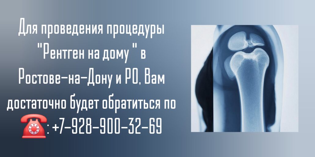 Ростов сделать рентген на дому