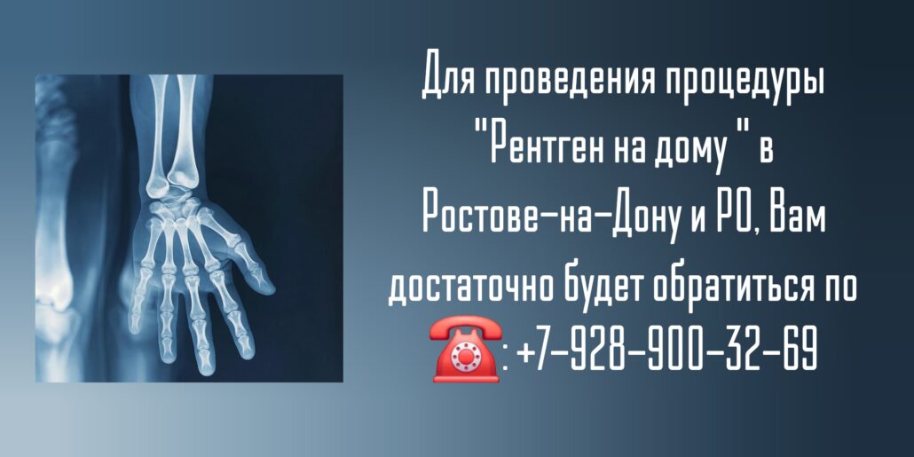 Ростов сделать рентген на дому