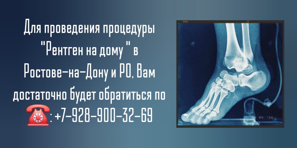 Ростов сделать рентген на дому