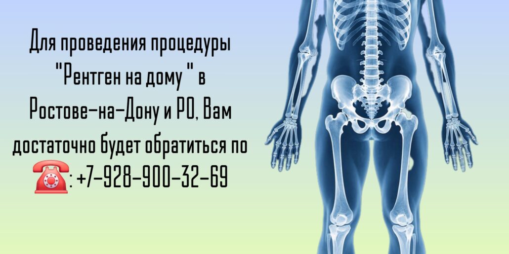 Ростов сделать рентген на дому