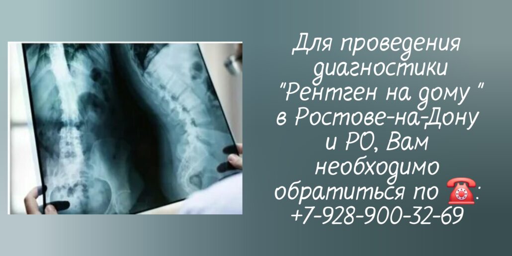 Ростов - рентген - вызов на дом врача