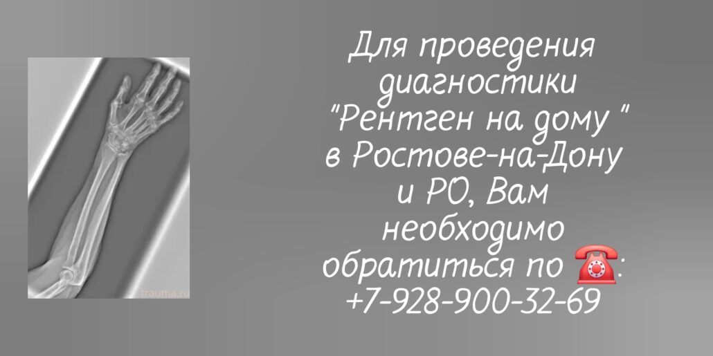 Ростов - рентген - вызов на дом врача