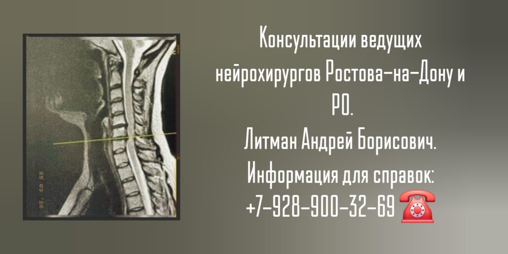 Ростов нейрохирург - Андрей Борисович Литман