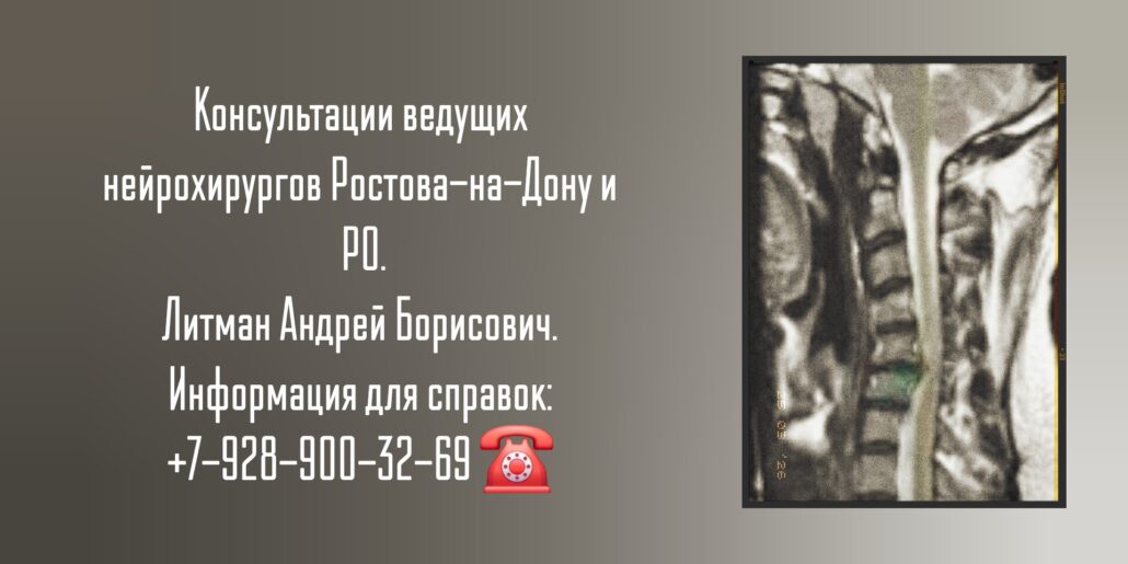 Ростов нейрохирург - Андрей Борисович Литман