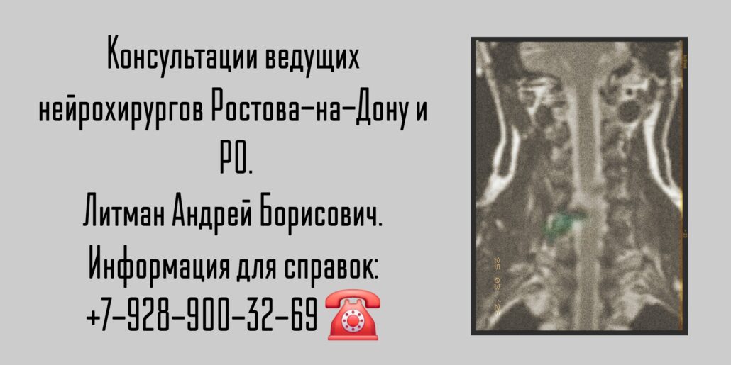 Ростов нейрохирург - Андрей Борисович Литман