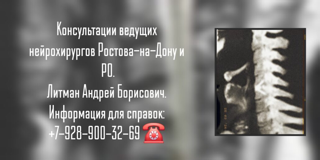 Ростов нейрохирург - Андрей Борисович Литман