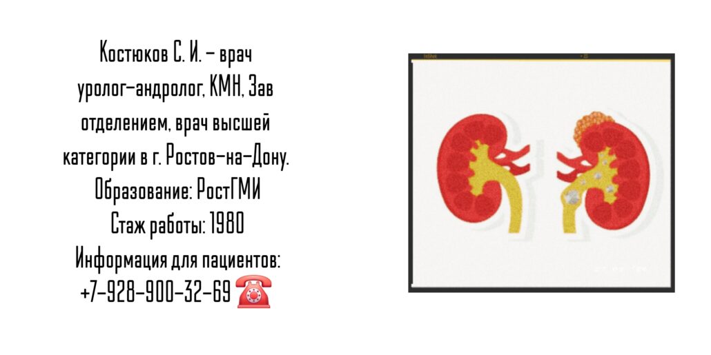 Костюков Сергей Иванович - уролог - андролог Ростов