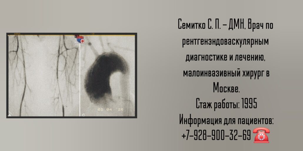 Семитко Сергей Петрович - хирург Москва