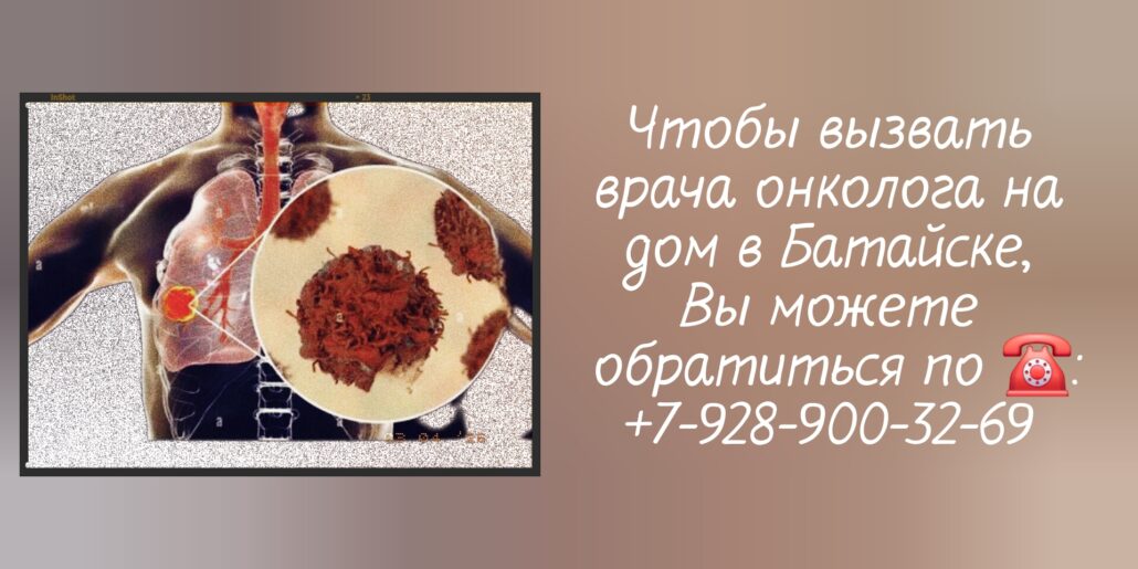 Как вызвать онколога на дом в Батайске?