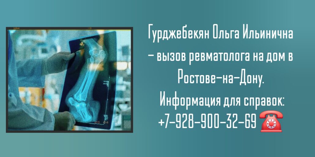 Гурджебекян Ольга Ильинична - ревматолог на дом Ростов