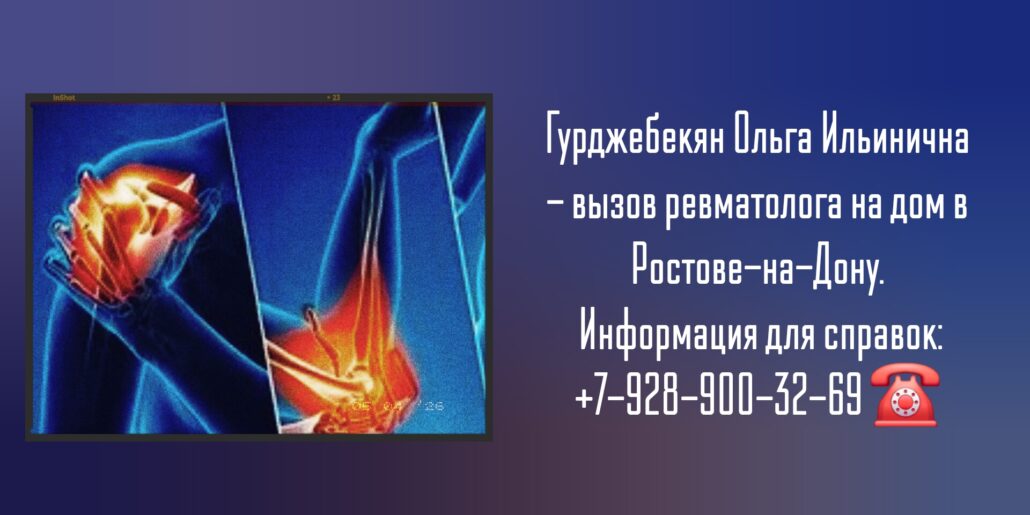 Гурджебекян Ольга Ильинична - ревматолог на дом Ростов