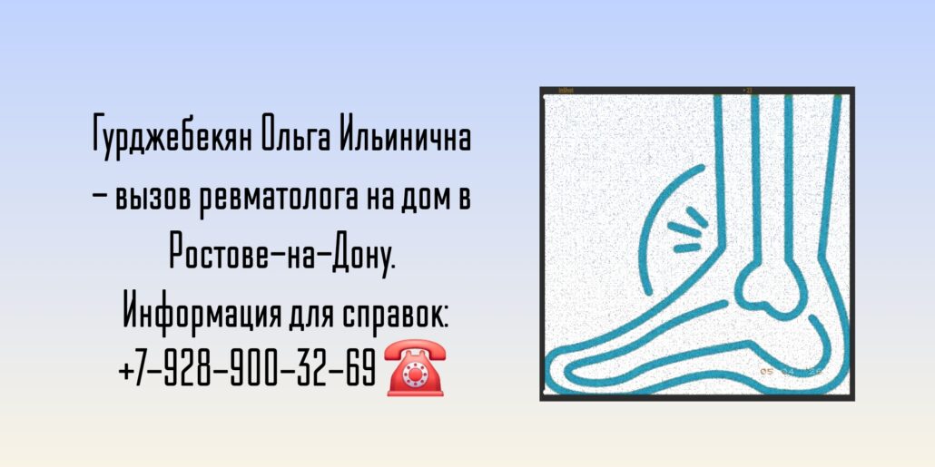 Гурджебекян Ольга Ильинична - ревматолог на дом Ростов
